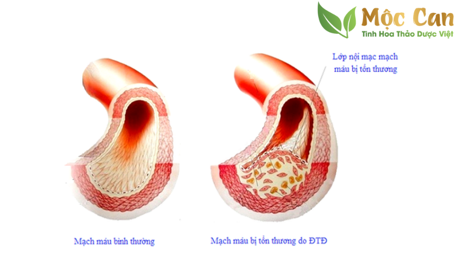 Biện pháp bảo vệ sức khỏe người tiểu đường trước dịch bệnh 1 Biện pháp bảo vệ sức khỏe người tiểu đường trước dịch bệnh 1